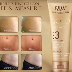 crème anti vergeture